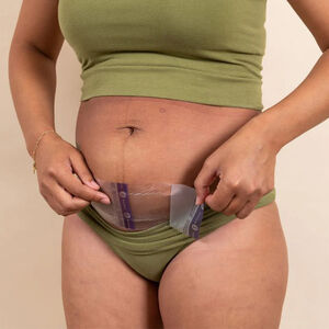 Boîte de 2 patchs hydrogels post césarienne 